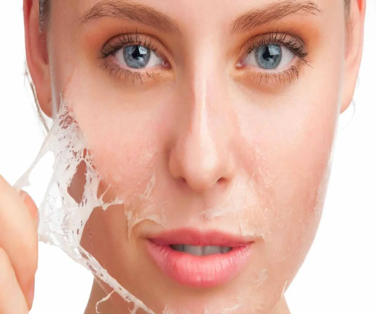 لایه برداری و پاکسازی پوست | انواع روش های لایه برداری و پاکسازی | دلایل پوسته پوسته شدن پوست بعد از لایه برداری و پاکسازی |روشی برای جلوگیری از سوزش و پوسته پوسته شدن پوست در زمان لایه برداری و پاکسازی | 
